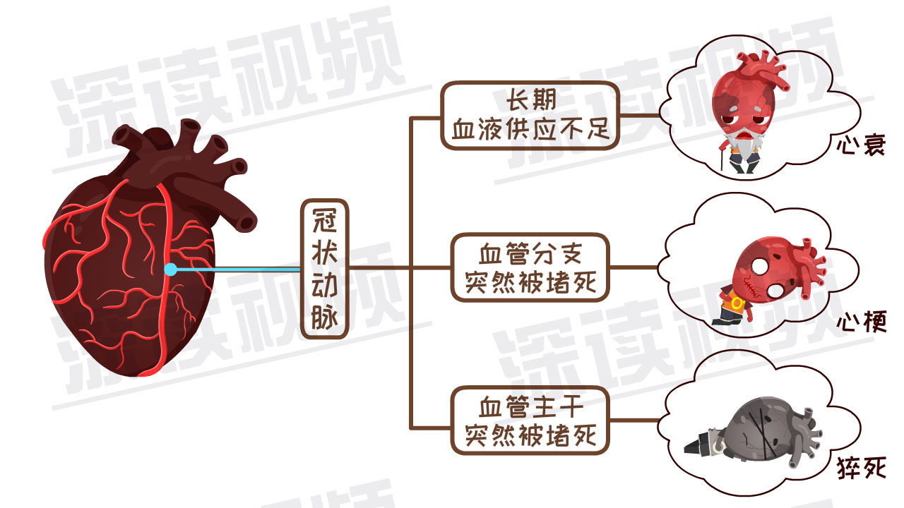 心绞痛会"潜伏"在哪些生活细节中?揭秘中年猝死!