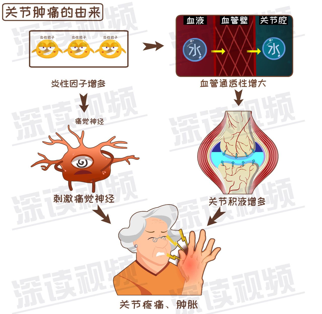 玩亲亲秀美腿23岁美女竟得类风湿关节炎快看预防全攻略