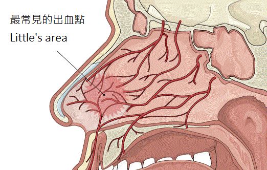 流鼻血的病理原因应急措施及常见误区