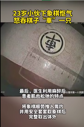 小伙下象棋时与人怄气怒吞一車 把象棋吃下去了 Acfun弹幕视频网 认真你就输啦 W ノ つロ