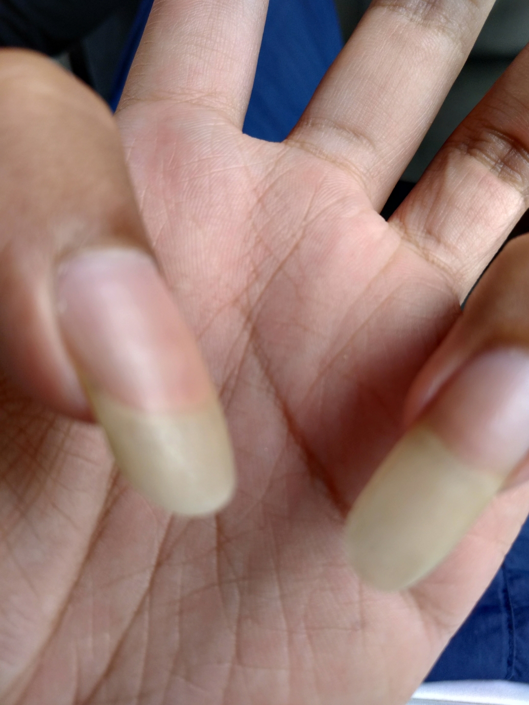 各位对男生留指甲有什么看法吗有图嫌恶心勿进