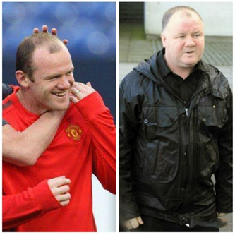 网传:曼联足球巨星,英国国家队队长,鲁尼脱发严重做了植发,植发还失败