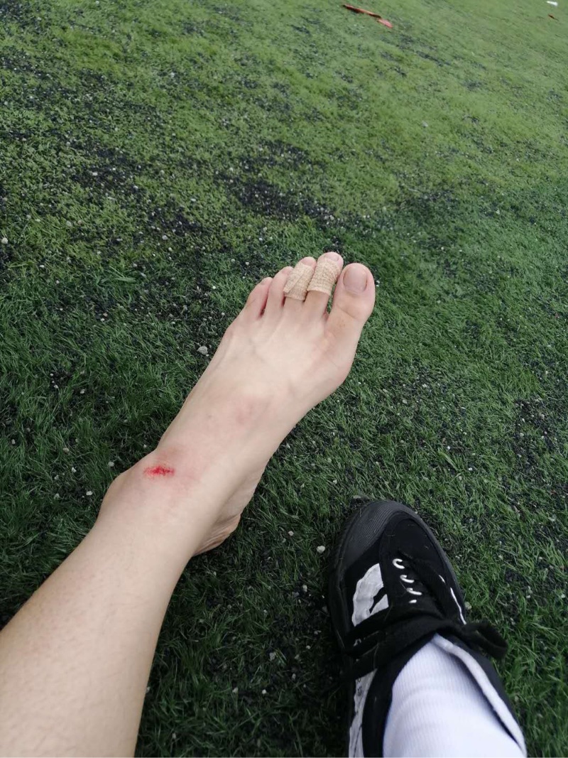 踢足球踢的满身伤