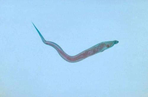 蛲虫又叫屁股虫,晚上睡觉屁股痒可能就是因为,当人睡眠后,肛门括约肌