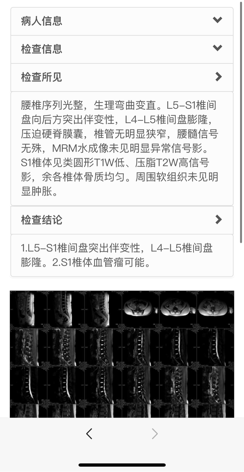 核磁共振有血管瘤可能又是什么 Acfun弹幕视频网 认真你就输啦 W ノ つロ