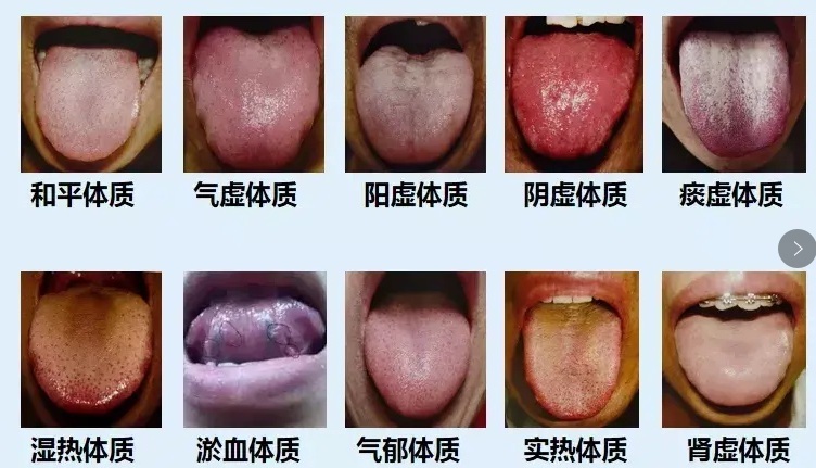 9种体质舌像分析一看就懂