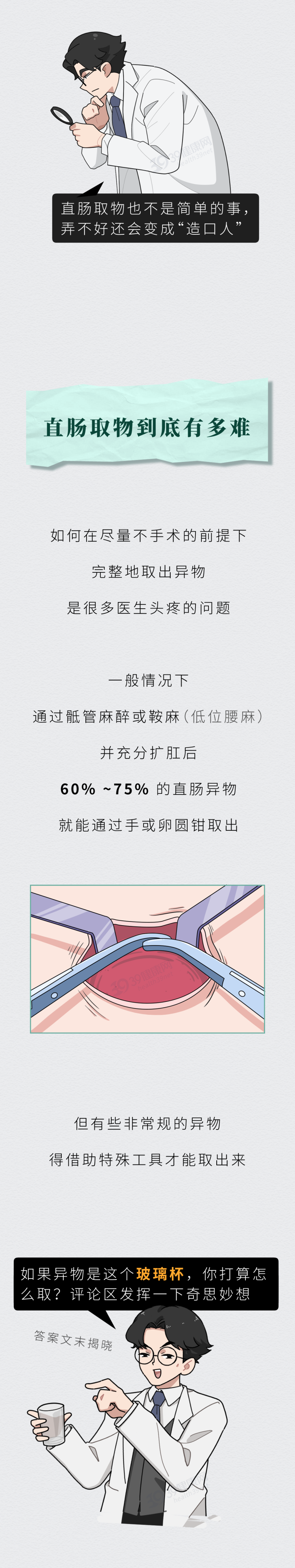 把灯泡塞进肛门是种什么体验4