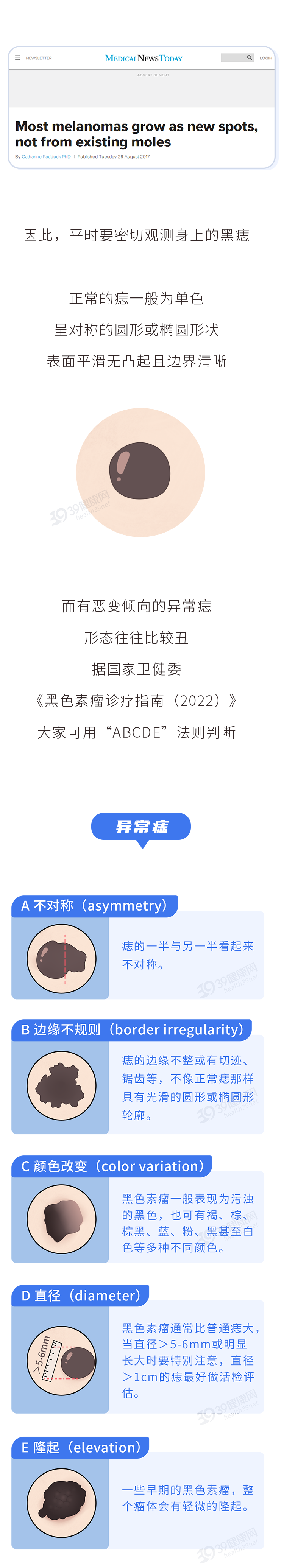 一旦皮肤上出现这种痣十有八九是癌症前兆要及时处理4