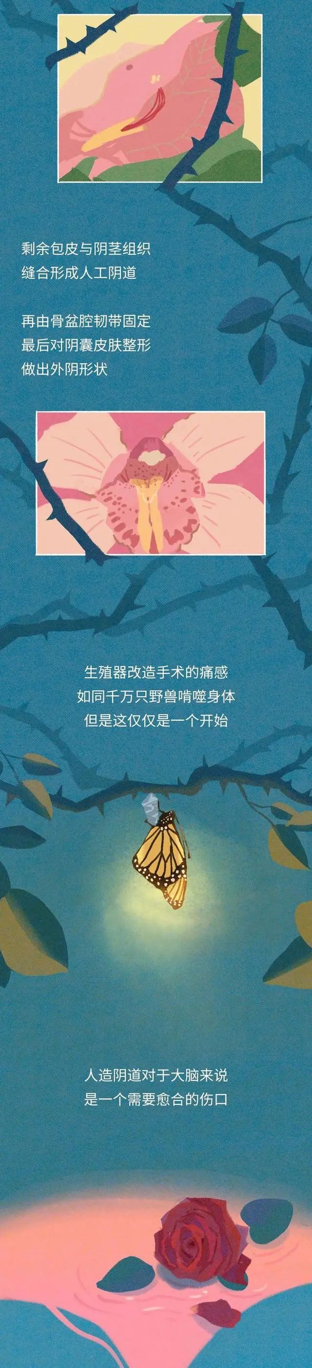 男人变成女人需要经过怎样的蜕变11