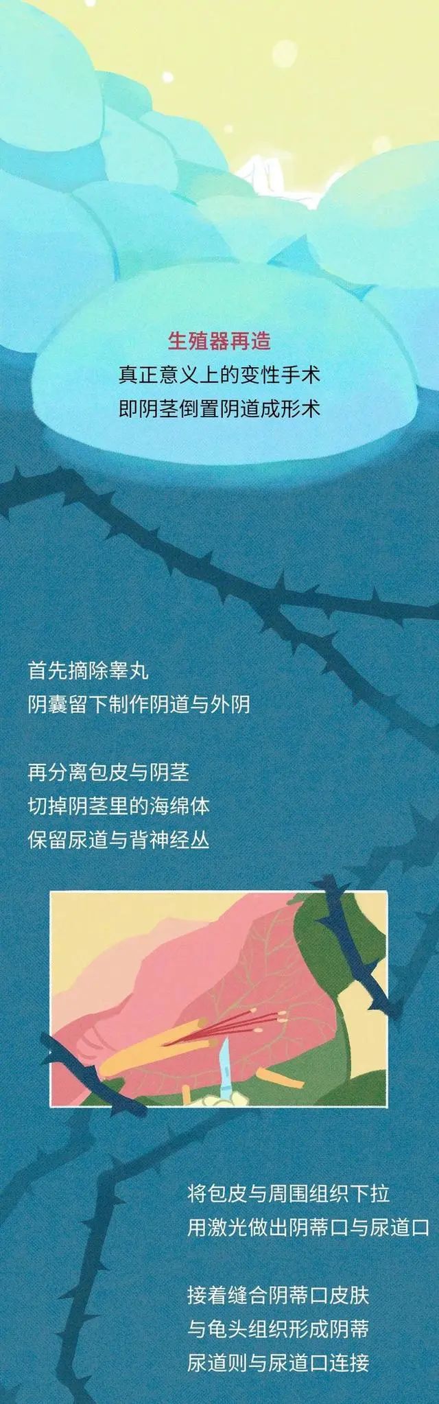 男人变成女人需要经过怎样的蜕变10