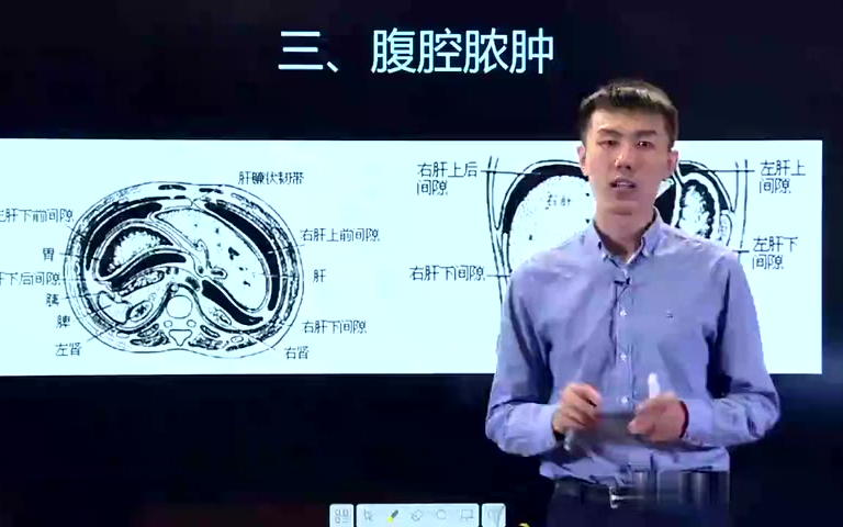 2025西综考研--徐琦外科学+外科学总论【31-40】 - AcFun弹幕视频网 - 认真你就输啦 (?ω?)ノ- ( ゜- ゜)つロ