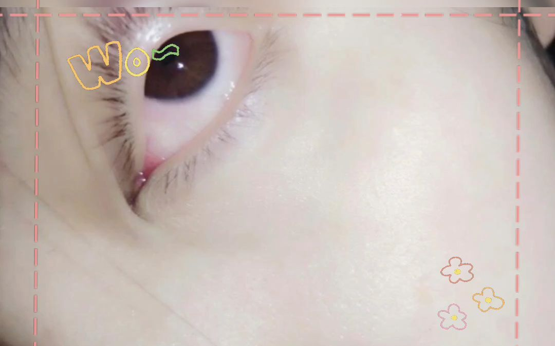 翻眼皮的技巧图片