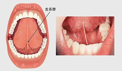 膜龈联合的位置图片