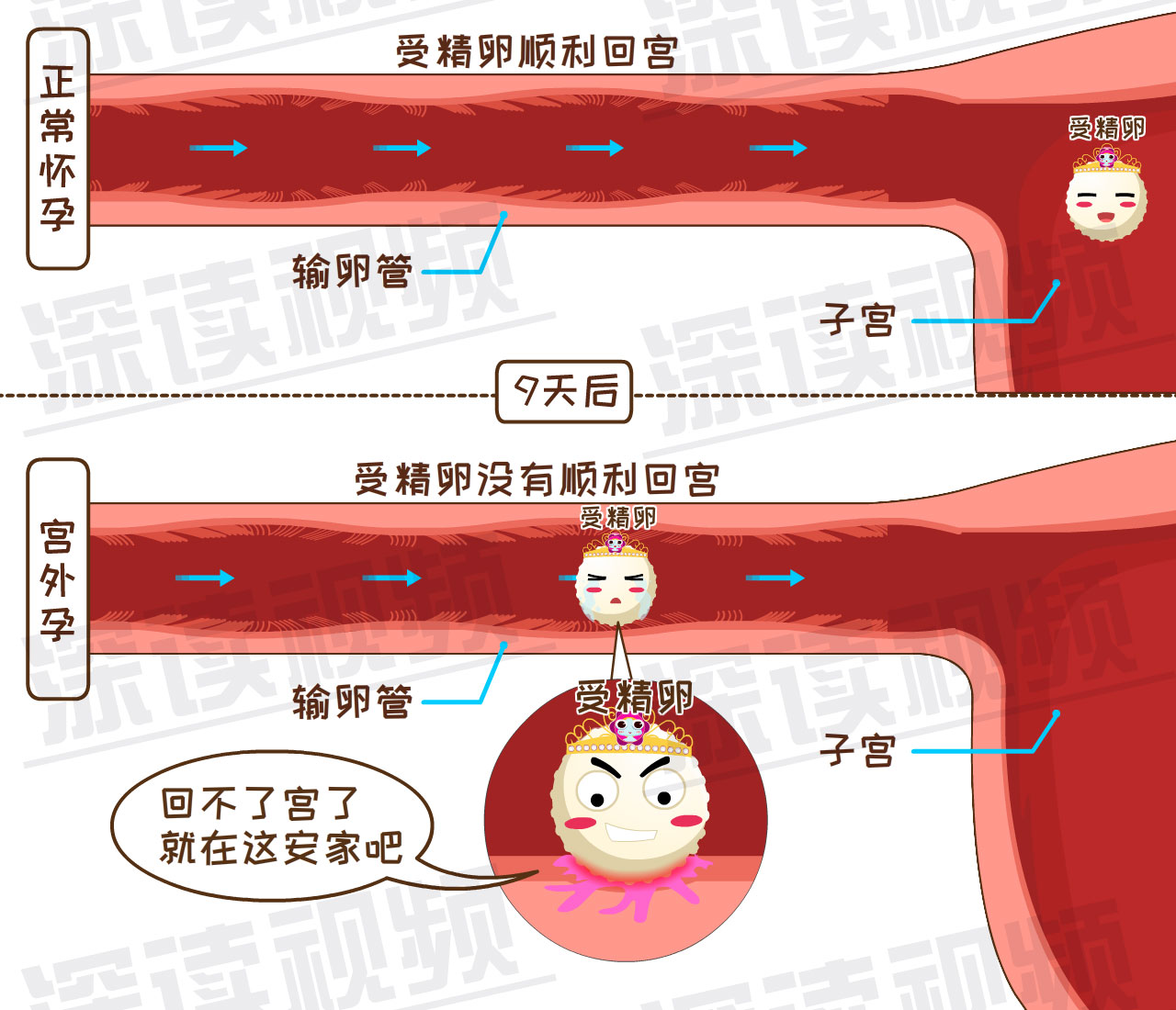 是输卵管不通?还是炎症,肿瘤在作妖?