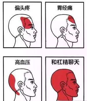 头疼部位分析